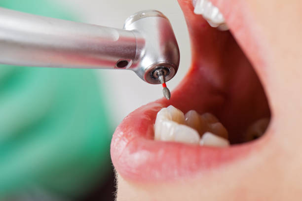 Best Emergency Cosmetic Dentistry in Basking Ridge, NJ